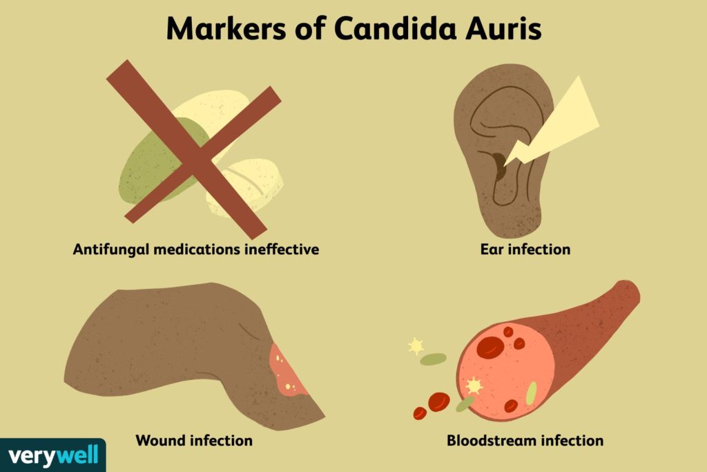 Origin of Covid 